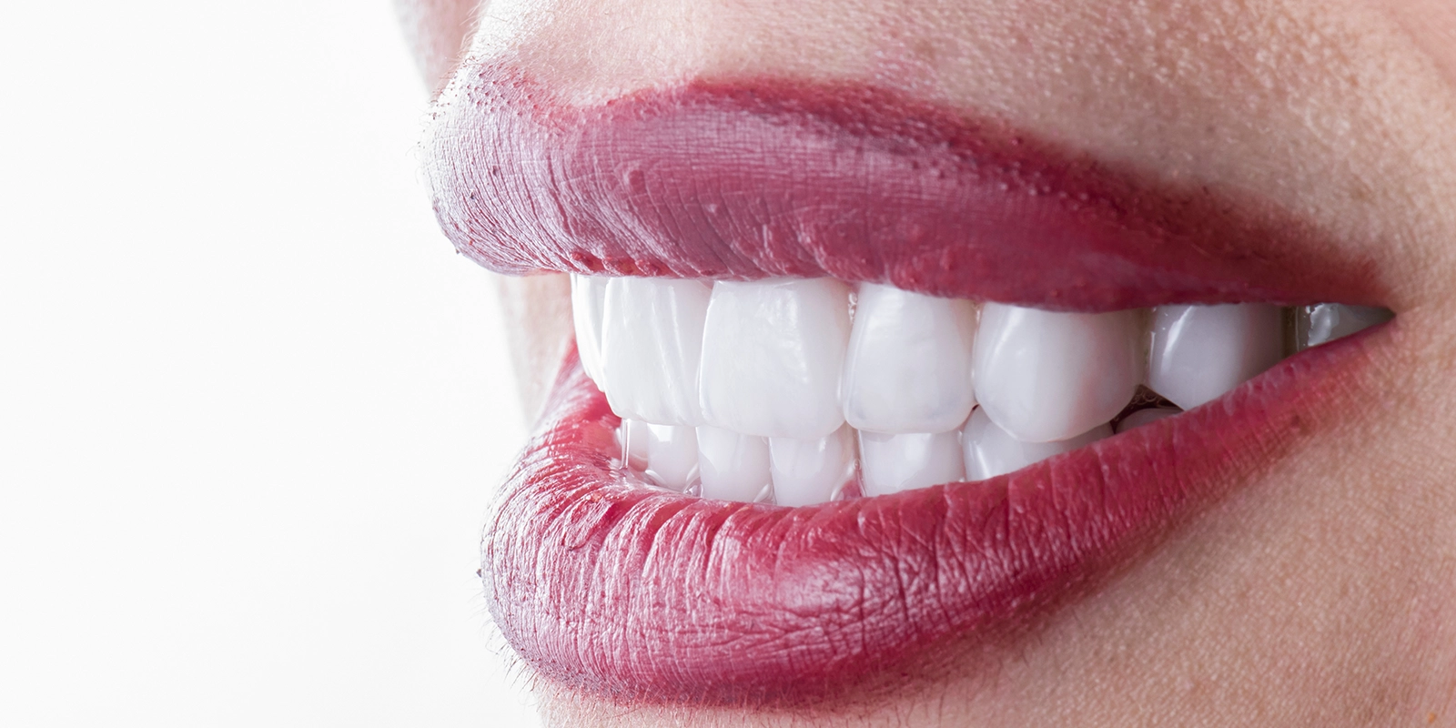 セラミック治療成功のポイント