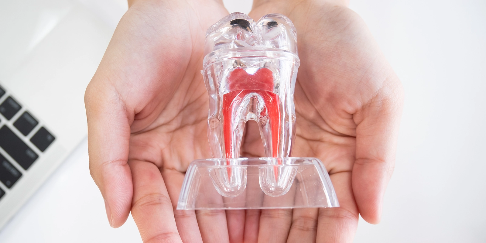 根管治療の価値